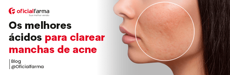 Mix de Ácidos Ajudam a Clarear Manchas de Acne e Melhoram Aparência do Rosto, conheça